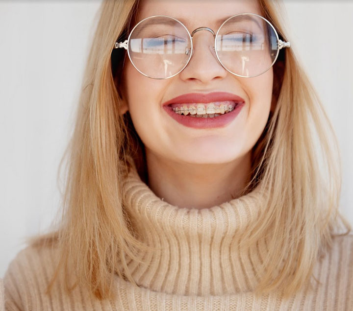 What are clear braces?  What are clear braces?