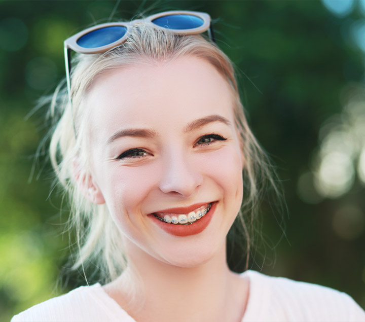 Benefits of clear braces  Benefits of clear braces